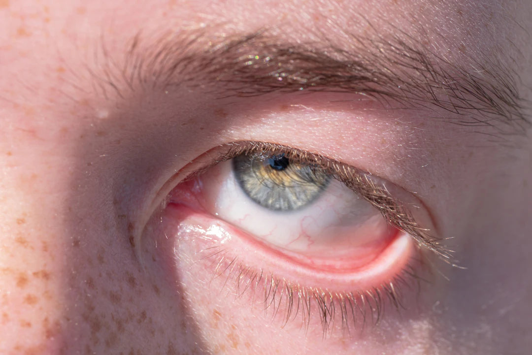 Symptomen van PFAS-blootstelling Wat Je Moet Weten